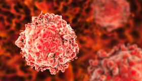 Cancro, la terapia Car-T funziona. “E’ il farmaco della vita”