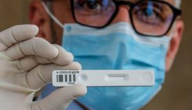 Covid, test sierologico e anticorpi: i valori che confermano l’immunità dopo il vaccino