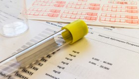 In arrivo pioggia di controlli sui ticket: chi rischia e cosa fare