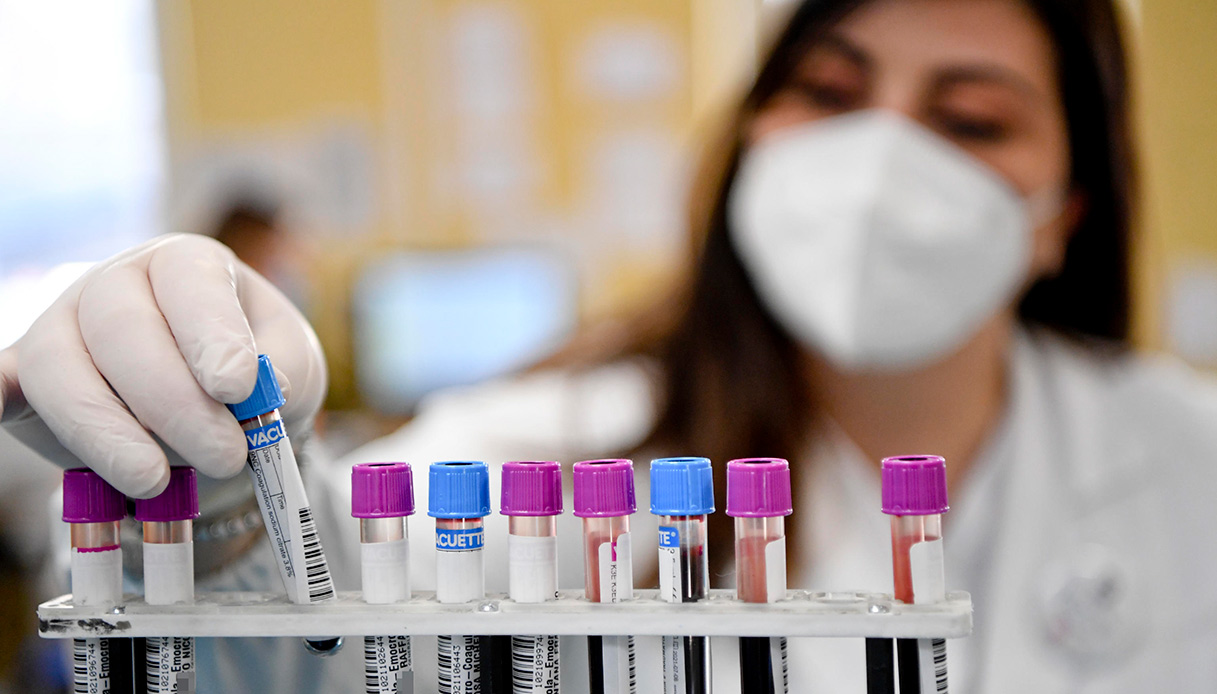 Dopo il Covid arriva un nuovo virus? È allerta per il NeoCov