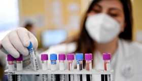 Dopo il Covid arriva un nuovo virus? È allerta per il NeoCov