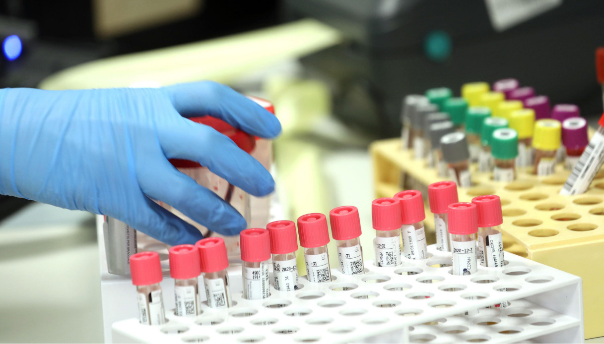 Omicron, nuova “variante” scoperta in Veneto: cosa sappiamo