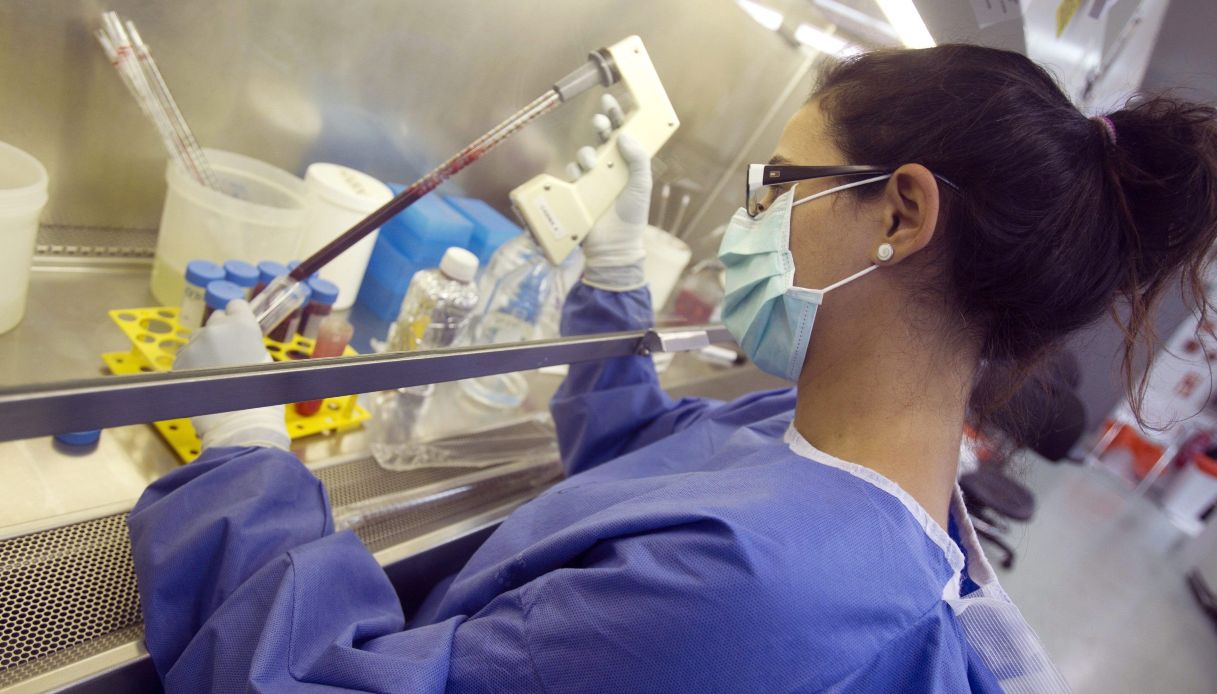 Brutte notizie dal vaccino Hiv: cosa succede