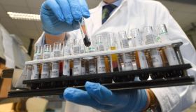 Trichinella, aumentano i casi: cos’è e come ci si infetta