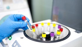 Come funziona il nuovo test per la diagnosi precoce del cancro