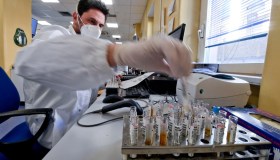 L’ameba mangia cervello preoccupa anche l’Italia. Lavaggi nasali con acqua dal rubinetto pericolosi?