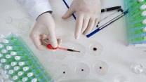 Mieloma multiplo, grazie a GIMEMA parte la nuova rete di laboratori per il controllo della malattia