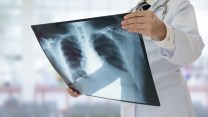 Concorso da 75 posti per infermieri e tecnici radiologi a Milano: requisiti e scadenza