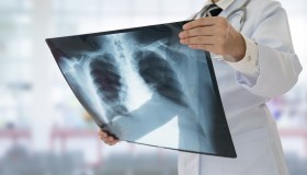 Concorso da 75 posti per infermieri e tecnici radiologi a Milano: requisiti e scadenza