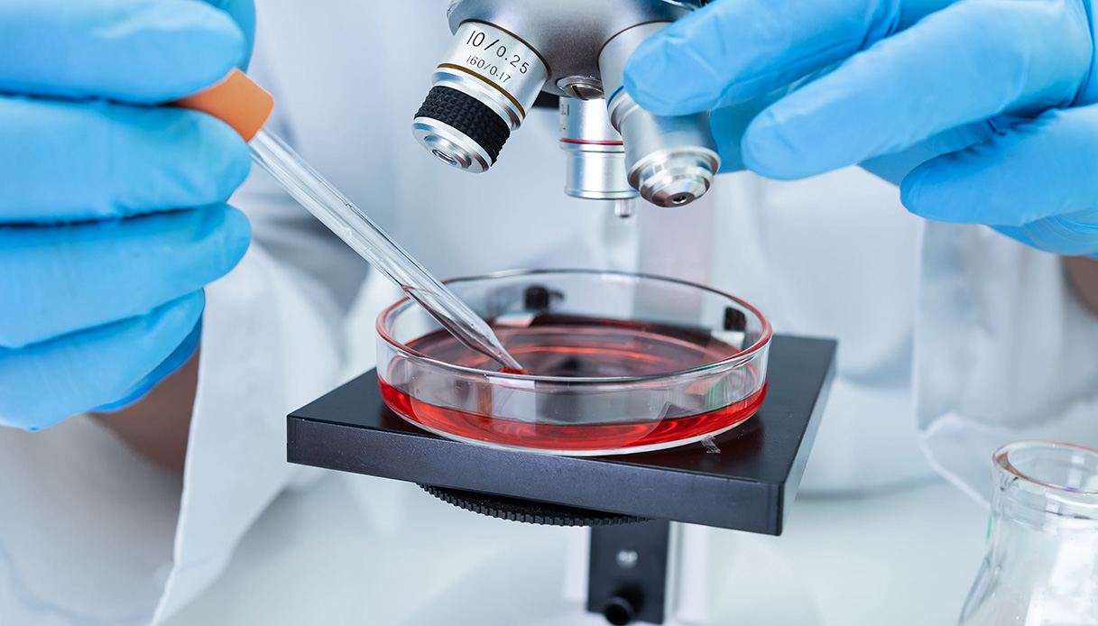 mielofibrosi e altre malattie mieloproliferative come si curano le nuove terapie da Quifinanza.it mielofibrosi e altre malattie mieloproliferative come si curano le nuove terapie