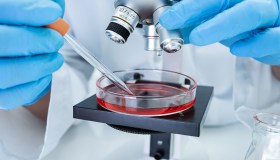 Mielofibrosi e altre malattie mieloproliferative, come si curano: le nuove terapie