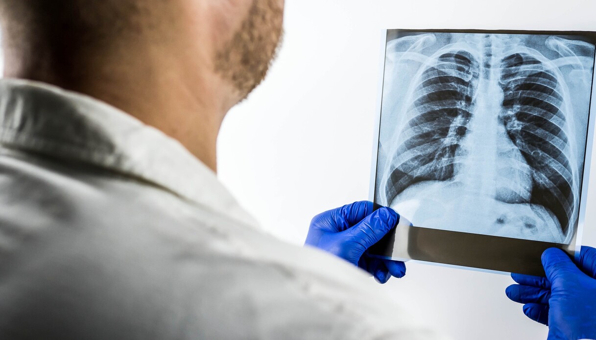 errore medico quando spetta il risarcimento il caso del tumore scoperto in ritardo da Quifinanza.it errore medico quando spetta il risarcimento il caso del tumore scoperto in ritardo