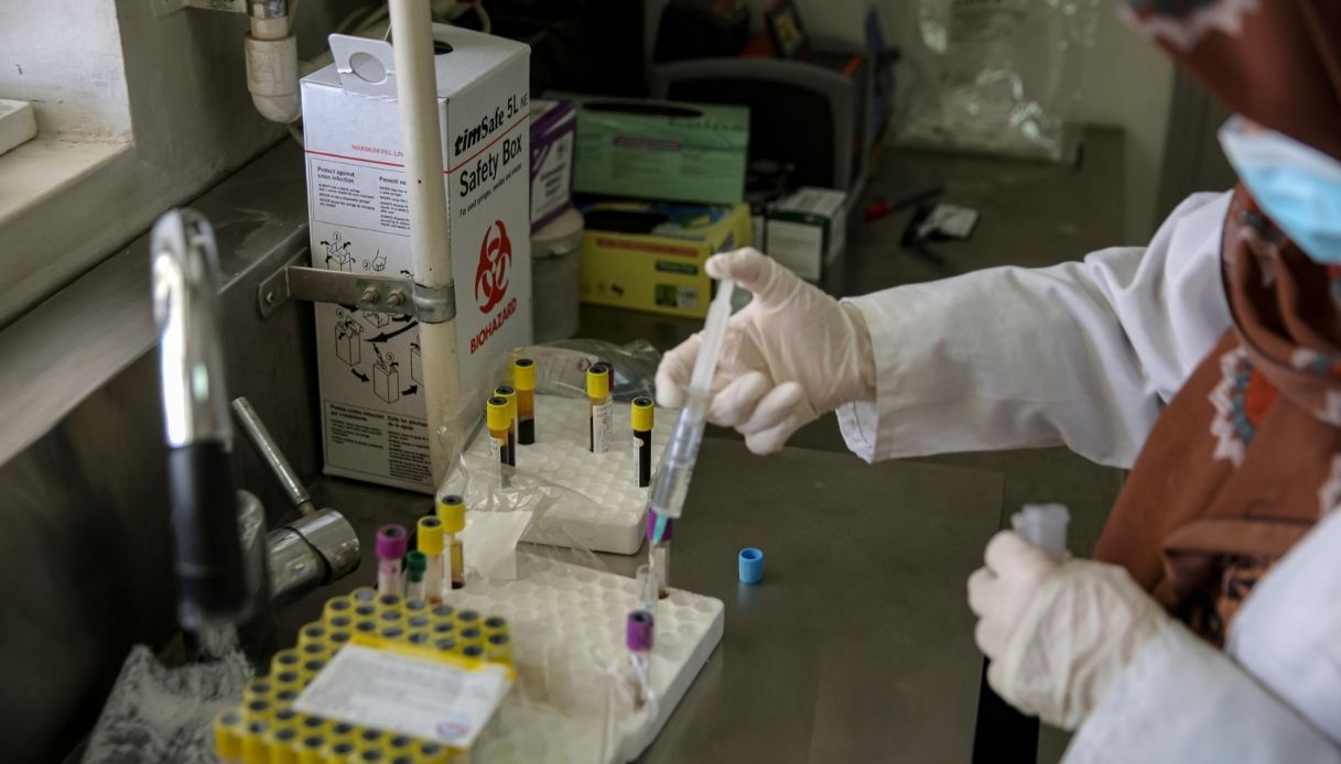 peste polmonare donna morta in siberia e 200 persone in quarantena cosa sappiamo da Quifinanza.it peste polmonare donna morta in siberia e 200 persone in quarantena cosa sappiamo