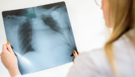 Lista attesa sanità in miglioramento, più prenotazioni: le regioni migliori e peggiori
